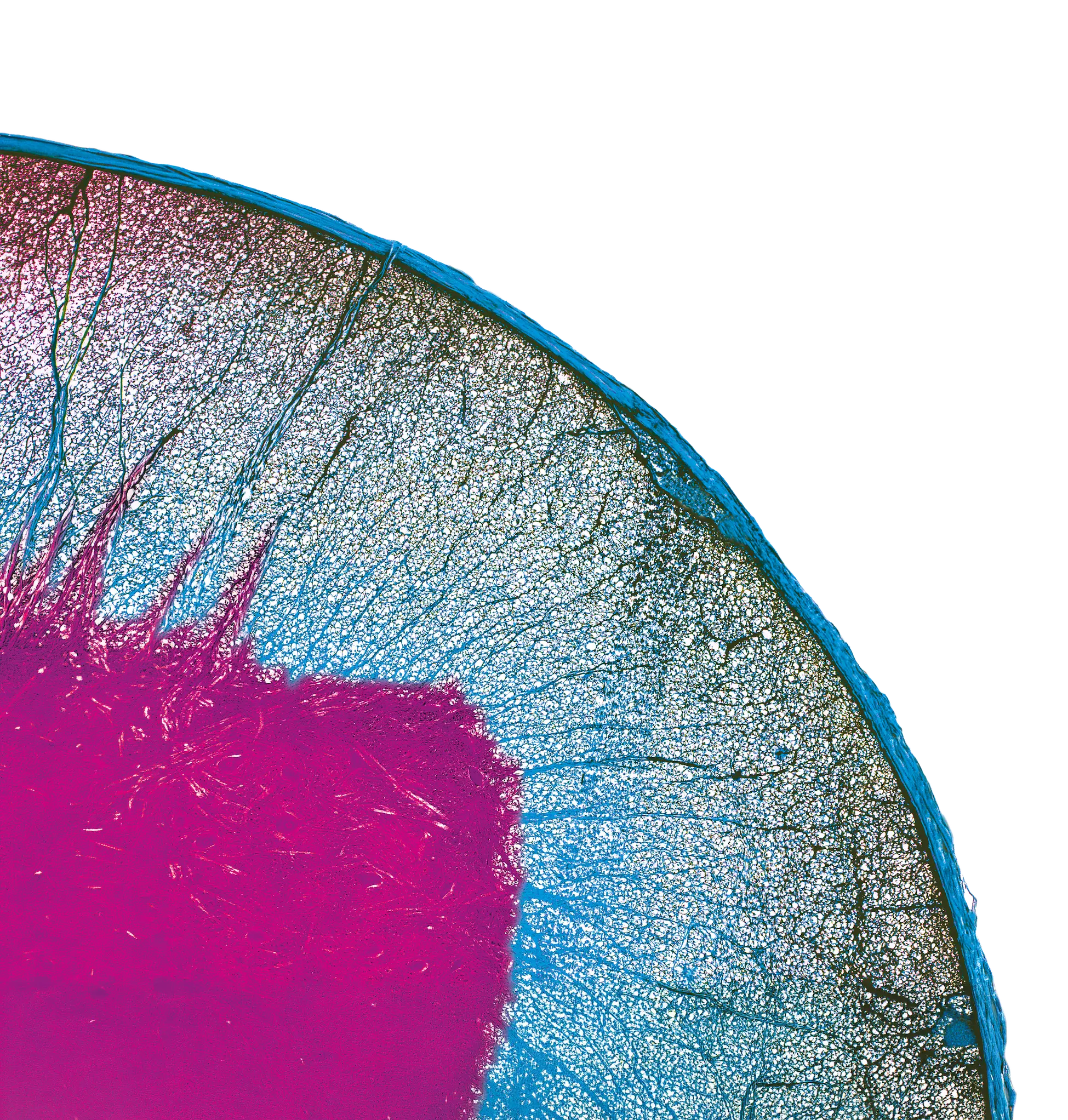 médecine de précision